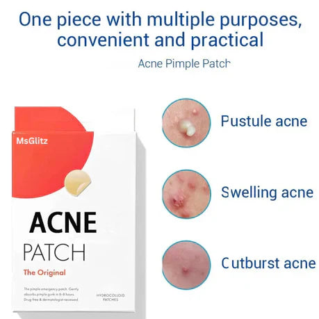 MsGlitz Acne Pimple Patch - Korean Skin Care - Clear - Lab Tested - 36's